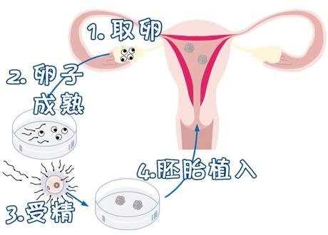代怀选性别包生男孩代生医院